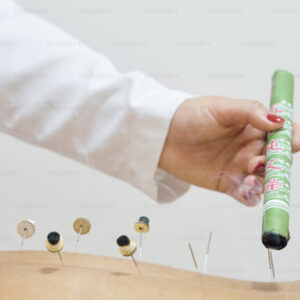 Addressing Lower Back Pain with Moxibustion